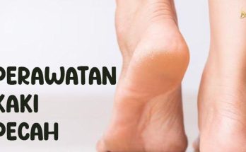 perawatan kaki pecah